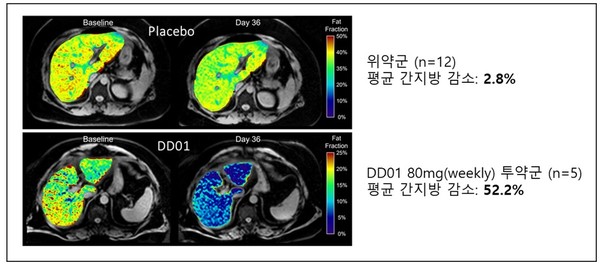 4주 투약 후 간지방 감소 결과(MRI-PDFF). 사진/디앤디파마텍