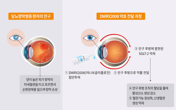 DWRX2008 점안 투여시 안구 내 약효 전달 과정. 사진/대웅테라퓨틱스